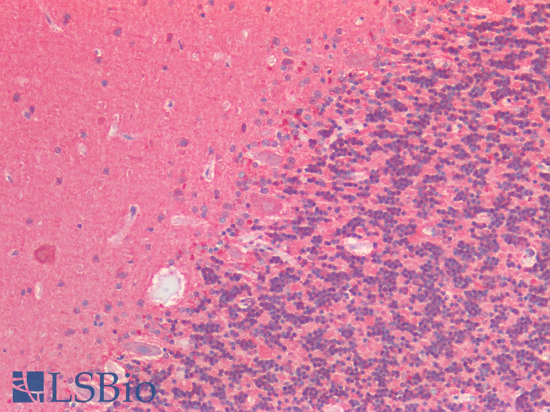 PathPlus™ Polyclonal Rabbit anti-Human BAD Antibody (IHC, WB)