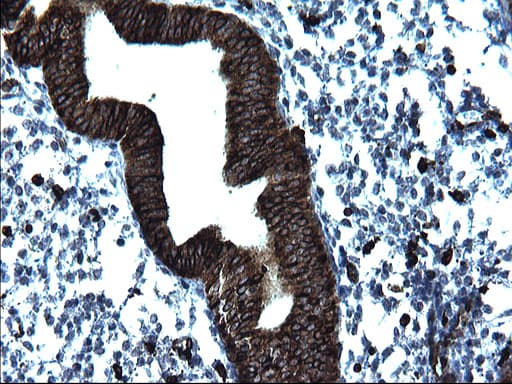 CD74 / CLIP Antibody (clone OTI1H3)