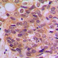 SMAD3 Antibody (phospho-Ser425)