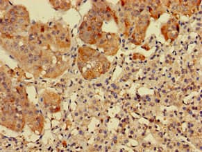 RPS5 / Ribosomal Protein S5 Antibody