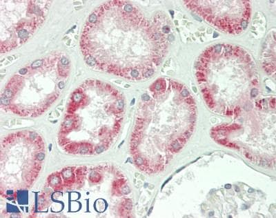 IFN Beta / Interferon Beta Antibody (aa22-187)