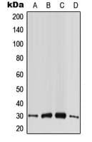 Polyclonal Rabbit anti-Human CABP4 Antibody (Internal, WB)