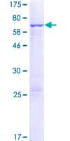 Human FANCF Protein (Recombinant GST)