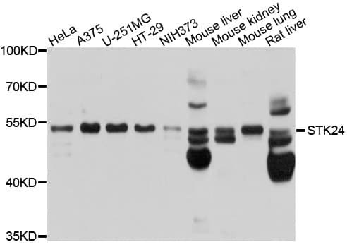 STK24 / MST3 Antibody