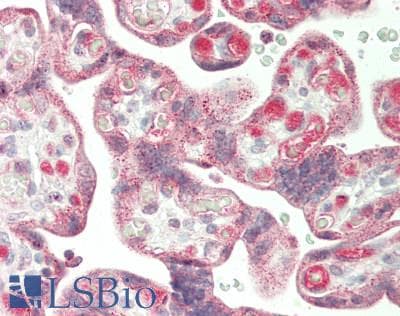IHC-plus™ Polyclonal Rabbit anti-Human ANTXR1 / TEM8 Antibody (IHC, IF, WB)