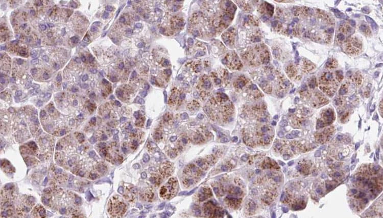 RAB12 Antibody
