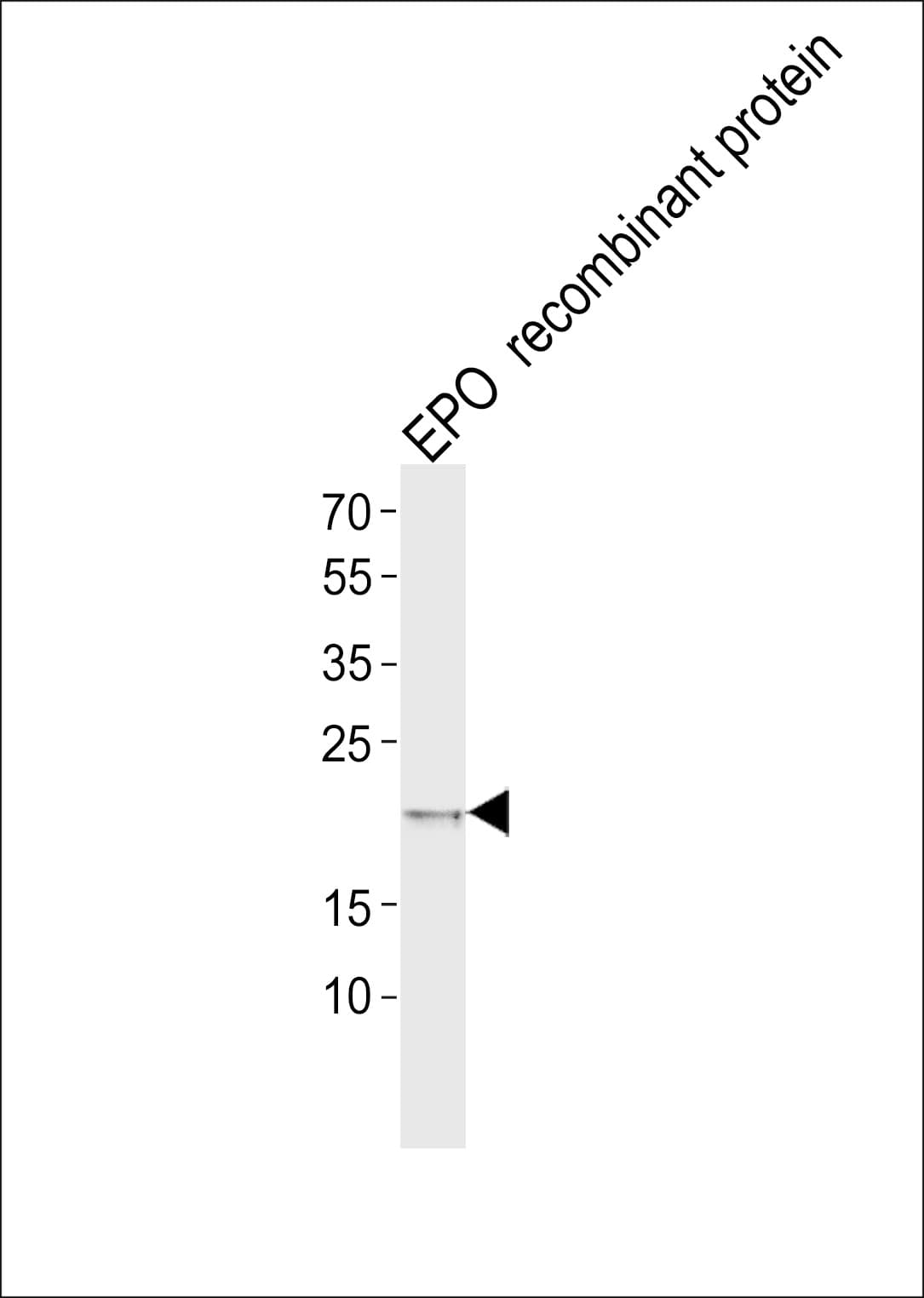 EPO / Erythropoietin Antibody (aa20-48)