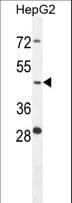 IHC-plus™ Polyclonal Rabbit anti-Human CTSA / Cathepsin A Antibody (aa18-45, IHC, WB)