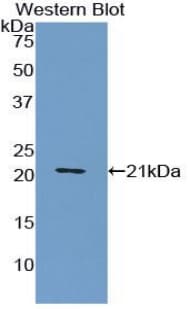 VWF / Von Willebrand Factor Antibody (aa1167-1334, PE)
