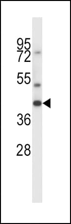 MAS1 / MAS Antibody (aa285-314)