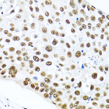 Polyclonal Rabbit anti-Human METTL3 Antibody (IHC, WB)