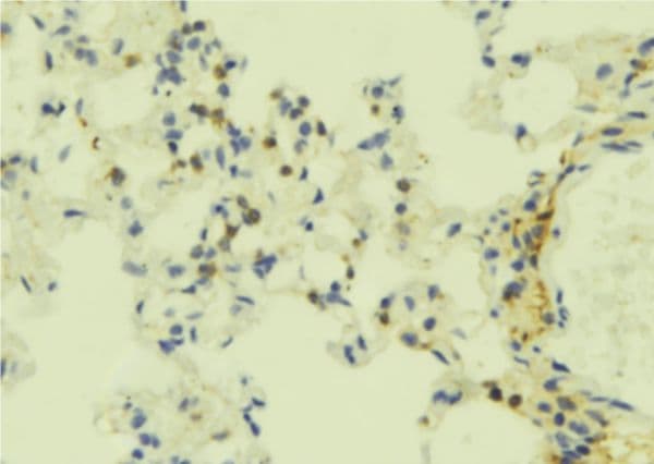 Polyclonal Rabbit anti-Human S1PR5 / EDG8 / S1P5 Antibody (IHC, WB)