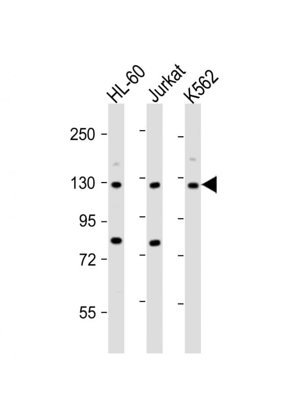 Polyclonal Rabbit anti-Human ATP2A3 / SERCA3 Antibody (aa13-47, IHC, WB)