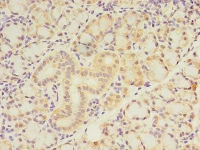 ZNF238 Antibody