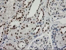 ERCC4 / XPF Antibody (clone OTI4E11)