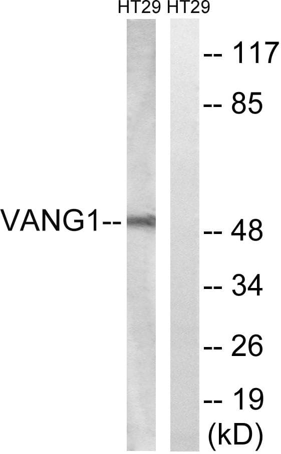 Polyclonal Rabbit anti-Human VANGL1 Antibody (WB)