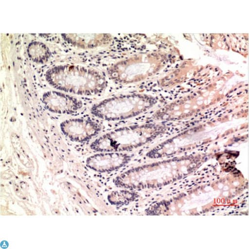 Monoclonal Mouse anti-Human TUBG1 / Tubulin Gamma 1 Antibody (IHC)