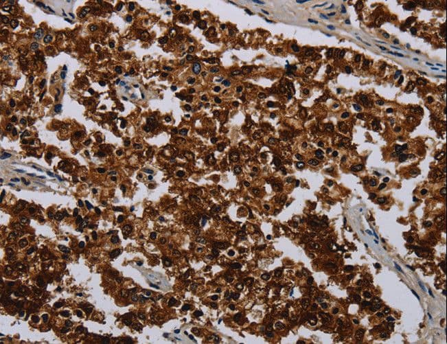 KLK11 / Kallikrein 11 Antibody