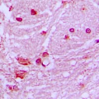 DNAL1 Antibody (Internal)