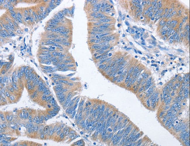 NCAPD2 Antibody