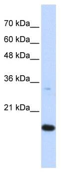 Polyclonal Rabbit anti-Human GABARAPL1 / ATG8 Antibody (N-Terminus, IHC, WB)