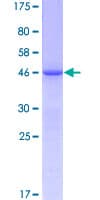 Human FGF12 Protein (Recombinant GST)