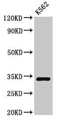 Polyclonal Rabbit anti-Human SET / TAF-I Antibody (WB)