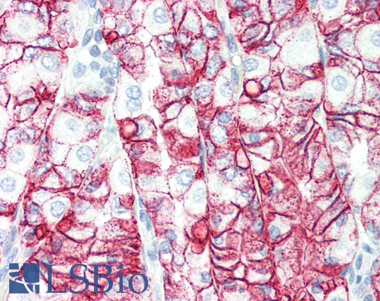PathPlus™ Monoclonal Mouse anti-Human CLDN18 / Claudin 18 Antibody (IHC)