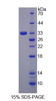 Rat MAP3K6 / MEKK6 Protein (Recombinant His-S)