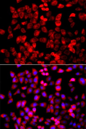 Polyclonal Rabbit anti-Human EIF4G1 / EIF4G Antibody (IHC, IF, WB)