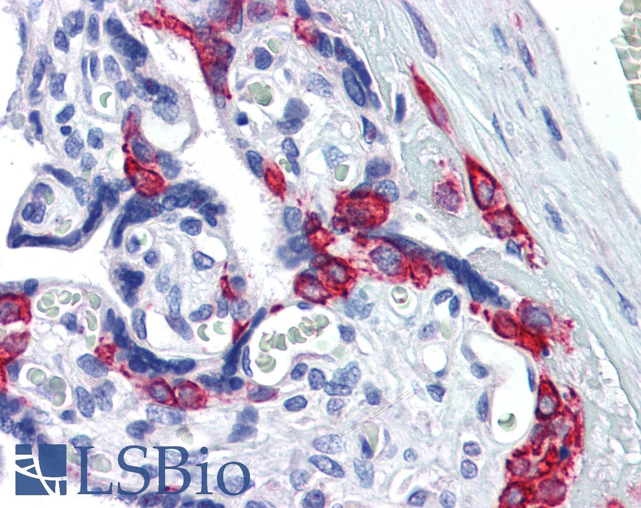 IHC-plus™ SERPINE1 / PAI-1 Antibody (aa71-85)