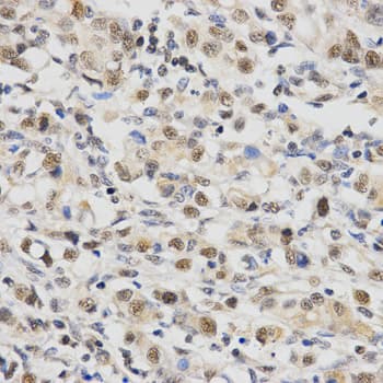 SNRPE Antibody