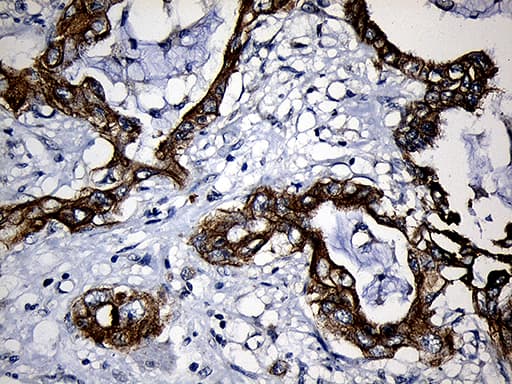 CPT1B Antibody (aa187-440, clone OTI2A6)