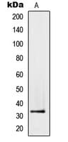 Polyclonal Rabbit anti-Human TMEPAI / PMEPA1 Antibody (Internal, IHC, WB)