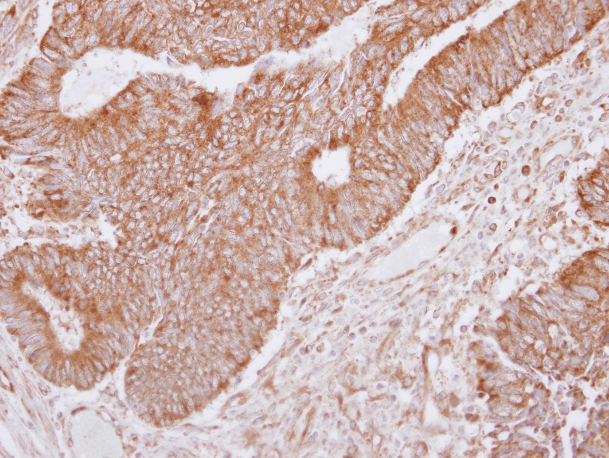 LANO / LRRC1 Antibody