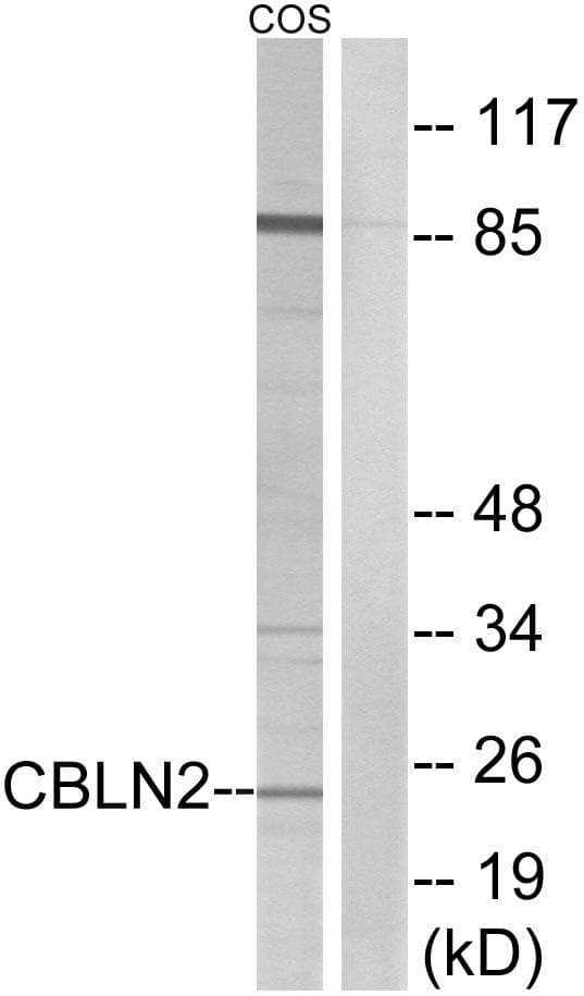 Polyclonal Rabbit anti-Human CBLN2 / Cerebellin 2 Antibody (WB)