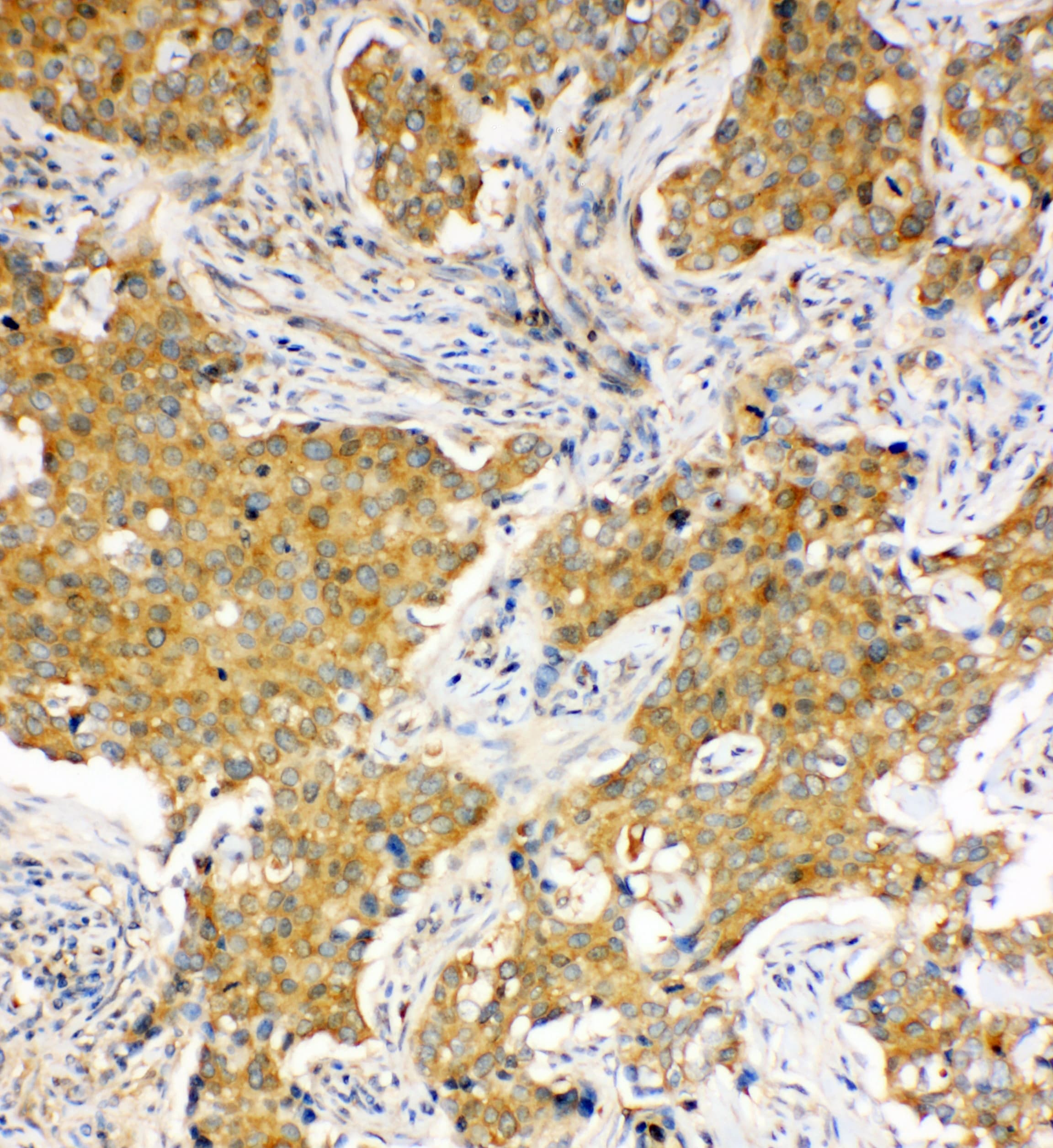 HSPA8 / HSC70 Antibody (aa563-582)