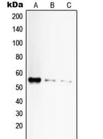 TNFRSF1A / TNFR1 Antibody (C-Terminus)