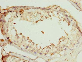 Polyclonal Rabbit anti-Human SCAPER Antibody (IHC)