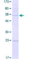 Human SPINT2 / HAI-2 Protein (Recombinant GST)