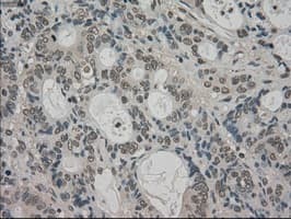 TRIB2 Antibody (clone OTI8D11)