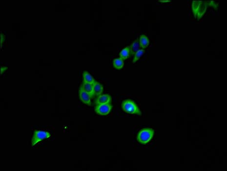 CD27L / CD70 Antibody