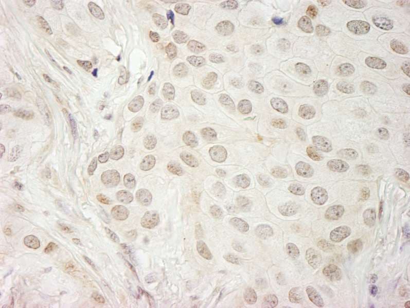 CASC5 Antibody (aa300-350)