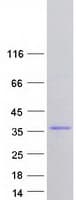 Human FAM76A Protein (Recombinant Myc-DDK (Flag))