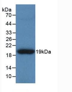 TNC / Tenascin C Antibody (aa49-181)