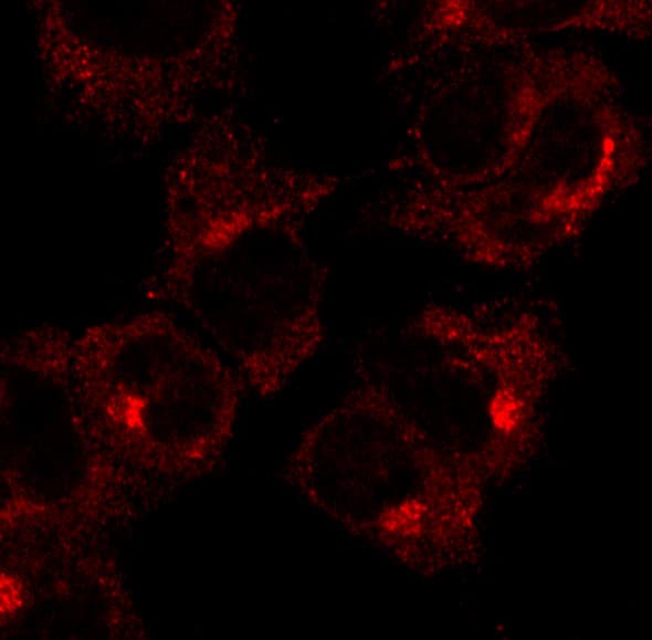 IHC-plus™ RAB1A Antibody (C-Terminus)