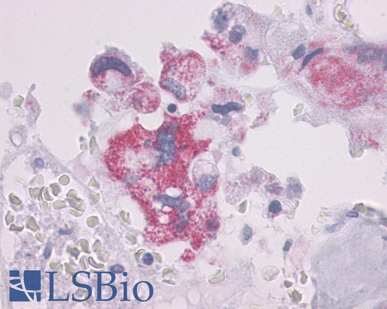 IHC-plus™ PTHR / PTHR1 Antibody (N-Terminus)