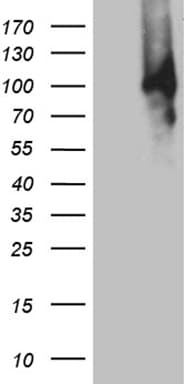 MUM1 Antibody (aa1-270, clone OTI4E1)