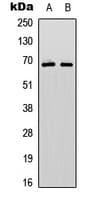 PAK1 + PAK2 + PAK3 Antibody (phospho-Ser144/Ser141/Ser139)