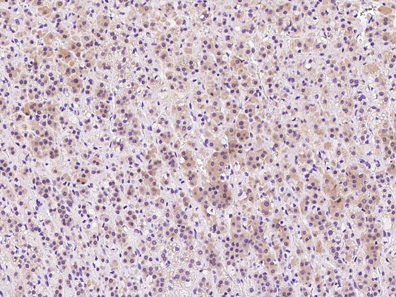 Polyclonal Rabbit anti-Human IFT20 Antibody (IHC)